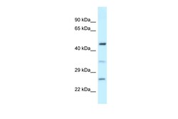 Aviva Systems Biology Corp MED18 Antibody - middle region (ARP62133_P050)