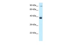 Aviva Systems Biology Corp TAGAP Antibody - N-terminal region (ARP62158_P050)
