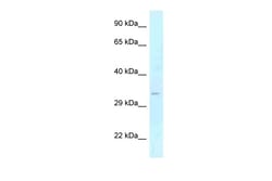 Aviva Systems Biology Corp GOLPH3 Antibody - middle region (ARP62176_P050)