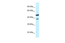 Aviva Systems Biology Corp HOMER3 Antibody - N-terminal region (ARP62178_P050)