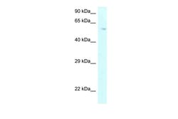 Aviva Systems Biology Corp P4HA2 Antibody - C-terminal region (ARP62190_P050)