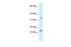 Aviva Systems Biology Corp UTS2D Antibody - C-terminal region (ARP62196_P050)