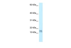Aviva Systems Biology Corp DNAL1 Antibody - N-terminal region (ARP62202_P050)