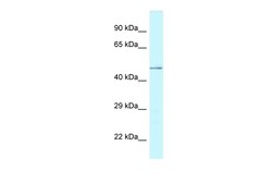 Aviva Systems Biology Corp CHI3L2 Antibody - N-terminal region (ARP62213_P050)