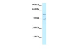 Aviva Systems Biology Corp GRINL1A Antibody - C-terminal region (ARP62221_P050)