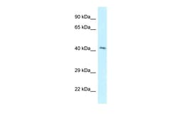 Aviva Systems Biology Corp GPER Antibody - C-terminal region (ARP62243_P050)
