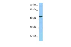 Aviva Systems Biology Corp GPER Antibody - C-terminal region (ARP62244_P050)