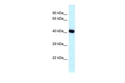 Aviva Systems Biology Corp BCAT2 Antibody - N-terminal region (ARP62251_P050)