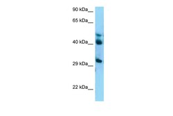 Aviva Systems Biology Corp BABAM2 Antibody - C-terminal region (ARP62254_P050)