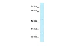 Aviva Systems Biology Corp CCDC85B Antibody - N-terminal region (ARP62259_P050)