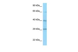 Aviva Systems Biology Corp CFHR1 Antibody - C-terminal region (ARP62262_P050)