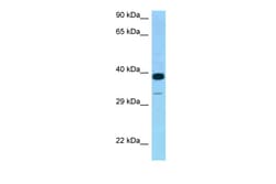 Aviva Systems Biology Corp CRELD2 Antibody - middle region (ARP62266_P050)