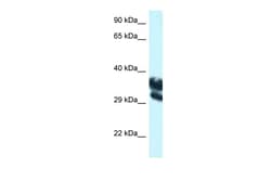 Aviva Systems Biology Corp EEF1D Antibody - C-terminal region (ARP62273_P050)
