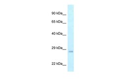 Aviva Systems Biology Corp GADD45GIP1 Antibody - middle region (ARP62333_P050)