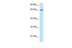 Aviva Systems Biology Corp MOXD1 Antibody - C-terminal region (ARP62346_P050)