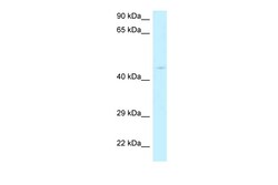 Aviva Systems Biology Corp RPP40 Antibody - N-terminal region (ARP62358_P050)