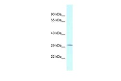 Aviva Systems Biology Corp BSPRY Antibody - N-terminal region (ARP62378_P050)