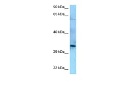 Aviva Systems Biology Corp PPP6C Antibody - N-terminal region (ARP62420_P050)
