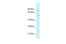 Aviva Systems Biology Corp C3orf15 Antibody - N-terminal region (ARP62434_P050)