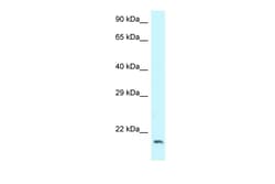 Aviva Systems Biology Corp DCTN3 Antibody - C-terminal region (ARP62445_P050)