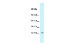 Aviva Systems Biology Corp NDUFA6 Antibody - C-terminal region (ARP62484_P050)