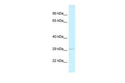 Aviva Systems Biology Corp RPA2 Antibody - N-terminal region (ARP62494_P050)