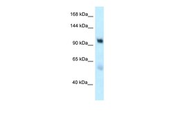 Aviva Systems Biology Corp EDEM3 Antibody - C-terminal region (ARP62508_P050)