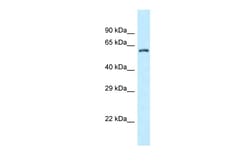 Aviva Systems Biology Corp ZC3H12A Antibody - C-terminal region (ARP62562_P050)