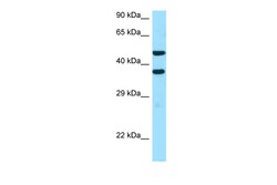 Aviva Systems Biology Corp SFXN2 Antibody - C-terminal region (ARP62590_P050)