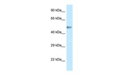 Aviva Systems Biology Corp BZW1 Antibody - C-terminal region (ARP62610_P050)