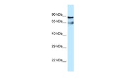 Aviva Systems Biology Corp CEP76 Antibody - middle region (ARP62645_P050)