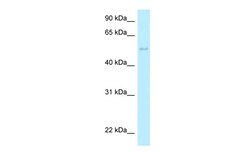 Aviva Systems Biology Corp HARS2 Antibody - C-terminal region (ARP62671_P050)
