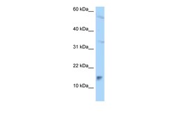 Aviva Systems Biology Corp MAGOHB Antibody - C-terminal region (ARP62679_P050)