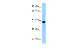 Aviva Systems Biology Corp MRPL3 Antibody - N-terminal region (ARP62688_P050)