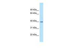 Aviva Systems Biology Corp MRPS9 Antibody - C-terminal region (ARP62694_P050)
