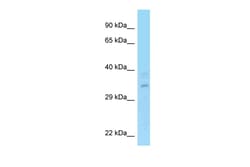 Aviva Systems Biology Corp RPRD1A Antibody - N-terminal region (ARP62702_P050)