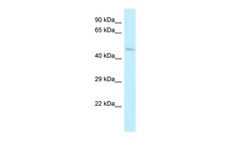 Aviva Systems Biology Corp ALDH3B2 Antibody - C-terminal region (ARP62748_P050)