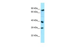 Aviva Systems Biology Corp BRAT1 Antibody - C-terminal region (ARP62762_P050)