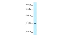 Aviva Systems Biology Corp CCDC102B Antibody - N-terminal region (ARP62777_P050)