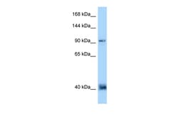 Aviva Systems Biology Corp DACT1 Antibody - N-terminal region (ARP62790_P050)