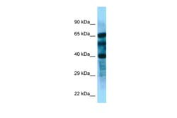 Aviva Systems Biology Corp FBXL8 Antibody - N-terminal region (ARP62816_P050)