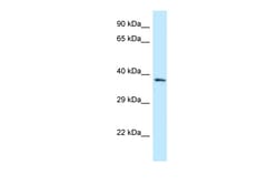Aviva Systems Biology Corp FPGT Antibody - C-terminal region (ARP62823_P050)