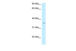 Aviva Systems Biology Corp GPN3 Antibody - C-terminal region (ARP62840_P050)