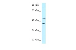 Aviva Systems Biology Corp HLA-E Antibody - C-terminal region (ARP62847_P050)