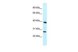 Aviva Systems Biology Corp MAGEF1 Antibody - N-terminal region (ARP62864_P050)