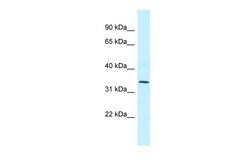 Aviva Systems Biology Corp MRPL1 Antibody - N-terminal region (ARP62868_P050)