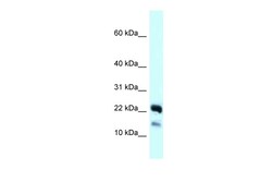 Aviva Systems Biology Corp NDUFB10 Antibody - C-terminal region (ARP62883_P050)