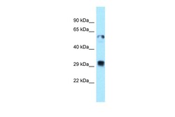 Aviva Systems Biology Corp TMX1 Antibody - C-terminal region (ARP62938_P050)