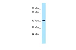 Aviva Systems Biology Corp UBE2Q1 Antibody - middle region (ARP62942_P050)