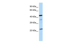 Aviva Systems Biology Corp AVPR1B Antibody - C-terminal region (ARP62994_P050)